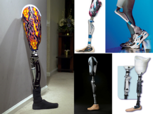 Lower Limb Prosthetics Archives - APC Prosthetics